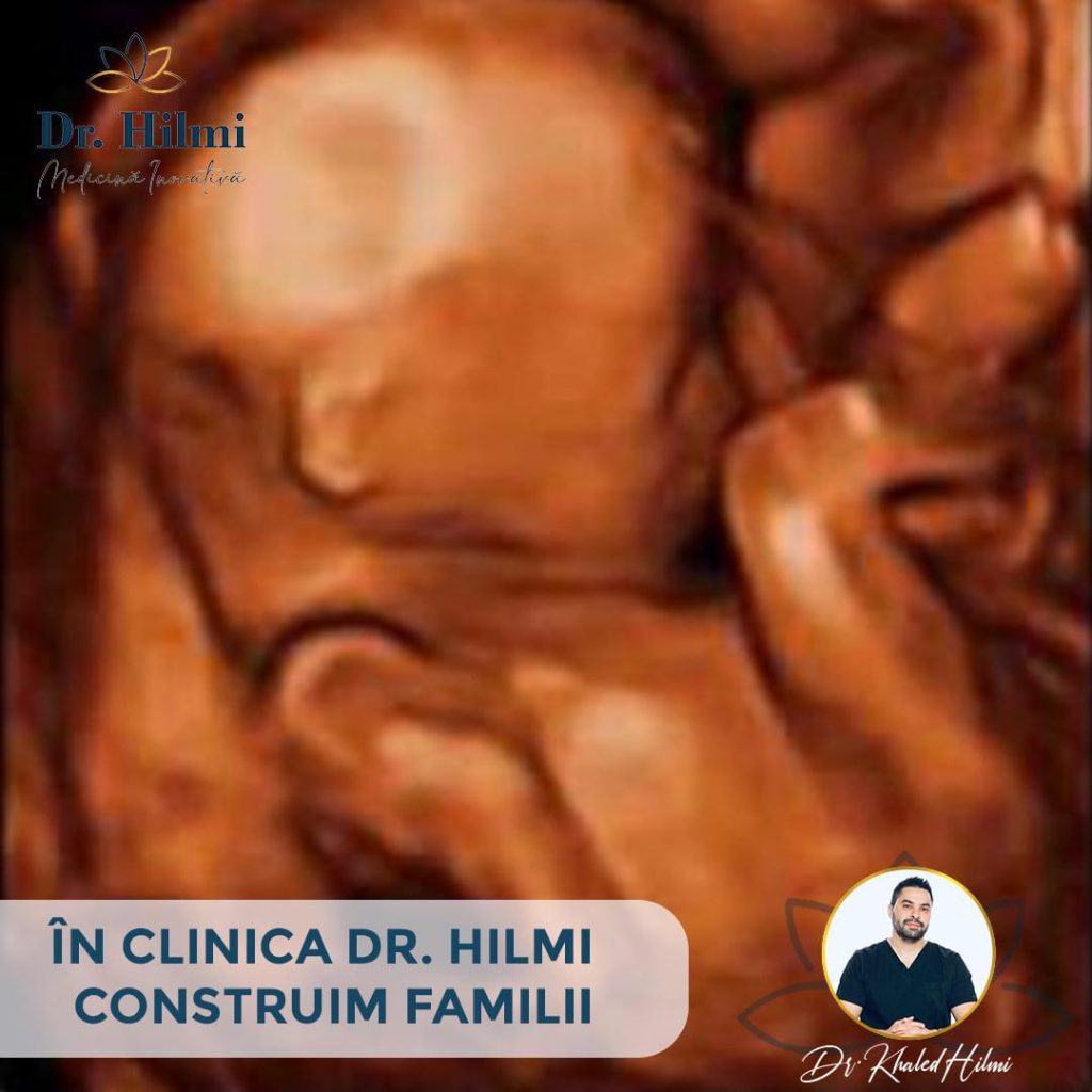 infertilitatea, histeroscopie, clinica de fertilitate dr. hilmi